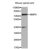 Western blot - MMP9 antibody from Signalway Antibody (38359) - Antibodies.com