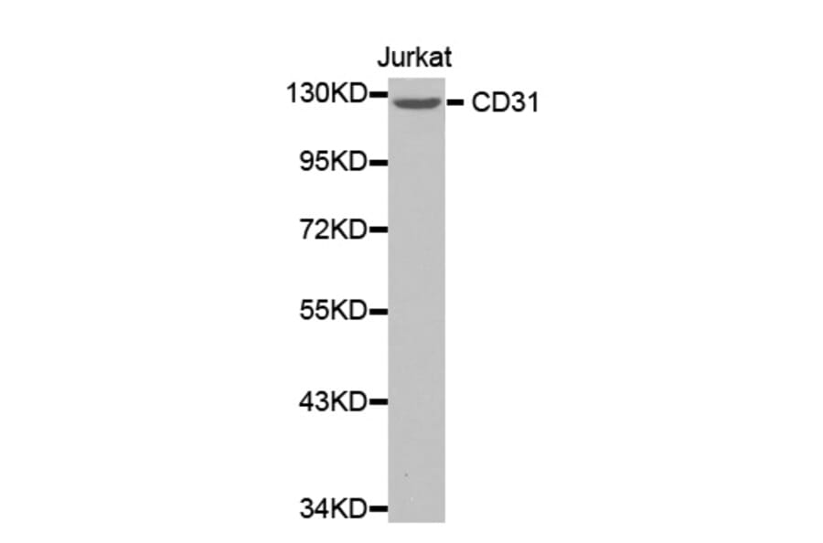 Western blot - CD31 antibody from Signalway Antibody (38365) - Antibodies.com