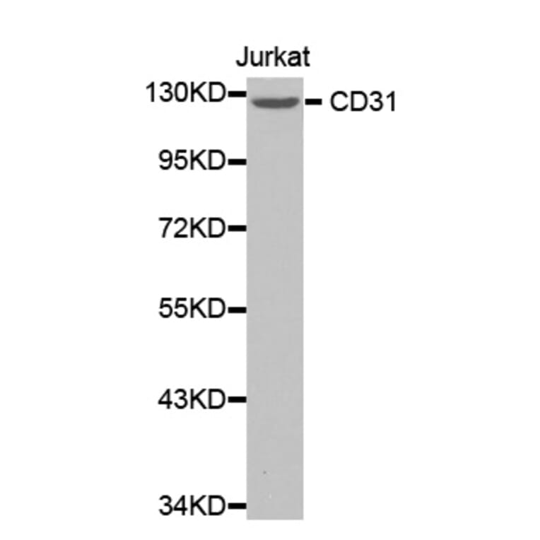 Western blot - CD31 antibody from Signalway Antibody (38365) - Antibodies.com