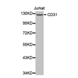Western blot - CD31 antibody from Signalway Antibody (38365) - Antibodies.com