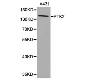 Western blot - PTK2 antibody from Signalway Antibody (38367) - Antibodies.com