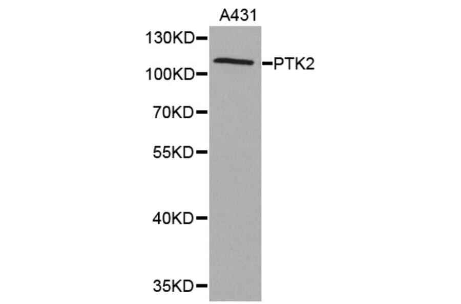 Western blot - PTK2 antibody from Signalway Antibody (38367) - Antibodies.com