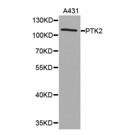 Western blot - PTK2 antibody from Signalway Antibody (38367) - Antibodies.com