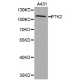 Western blot - PTK2 antibody from Signalway Antibody (38367) - Antibodies.com