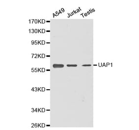 Western blot - UAP1 antibody from Signalway Antibody (38369) - Antibodies.com