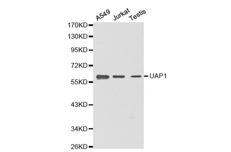 Western blot - UAP1 antibody from Signalway Antibody (38369) - Antibodies.com