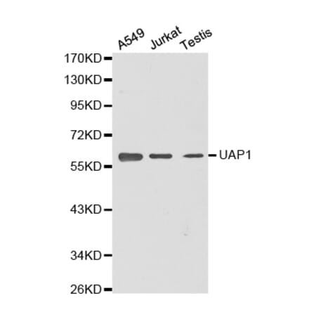 Western blot - UAP1 antibody from Signalway Antibody (38369) - Antibodies.com