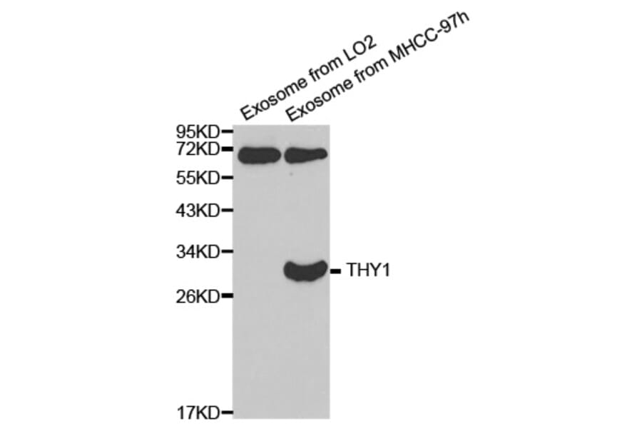 Western blot - THY1 antibody from Signalway Antibody (38373) - Antibodies.com