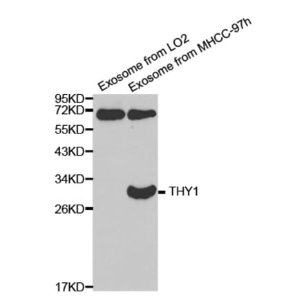 Western blot - THY1 antibody from Signalway Antibody (38373) - Antibodies.com