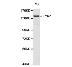 Western blot - TYK2 antibody from Signalway Antibody (38374) - Antibodies.com