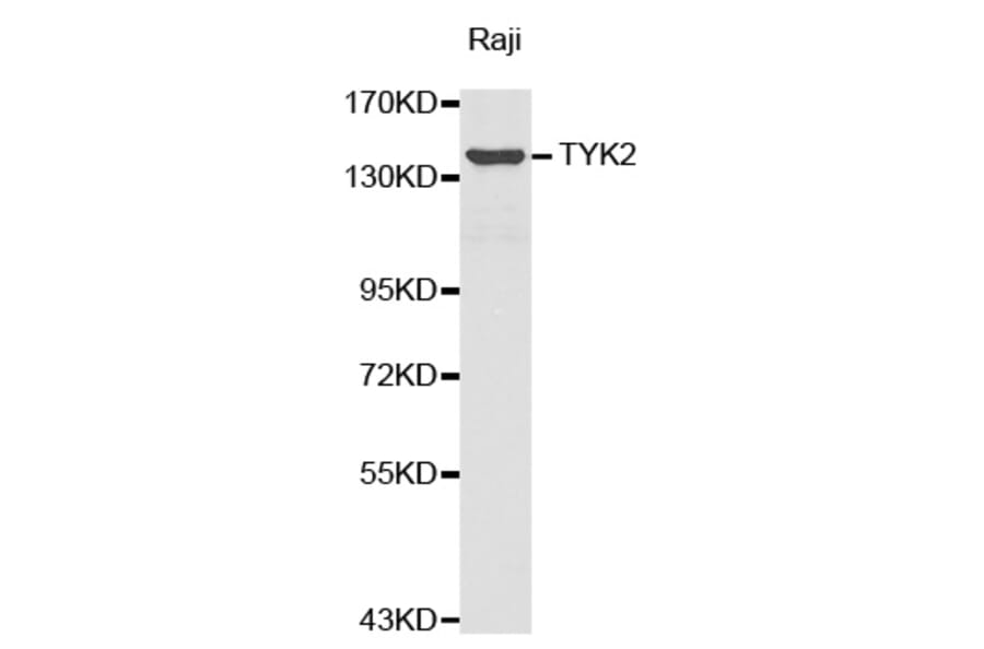 Western blot - TYK2 antibody from Signalway Antibody (38374) - Antibodies.com