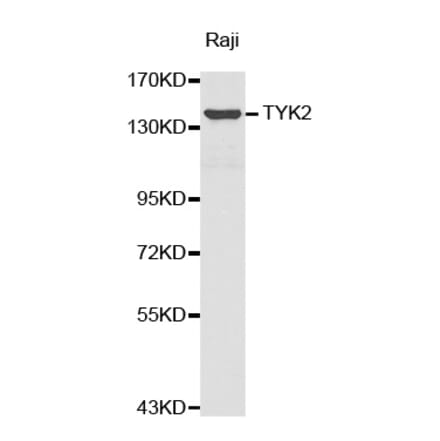Western blot - TYK2 antibody from Signalway Antibody (38374) - Antibodies.com