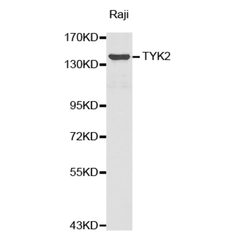 Western blot - TYK2 antibody from Signalway Antibody (38374) - Antibodies.com