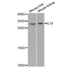 Western blot - IL10 antibody from Signalway Antibody (38392) - Antibodies.com