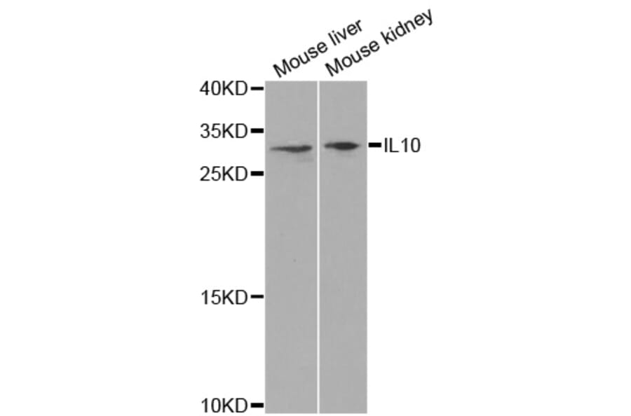 Western blot - IL10 antibody from Signalway Antibody (38392) - Antibodies.com