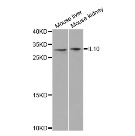 Western blot - IL10 antibody from Signalway Antibody (38392) - Antibodies.com