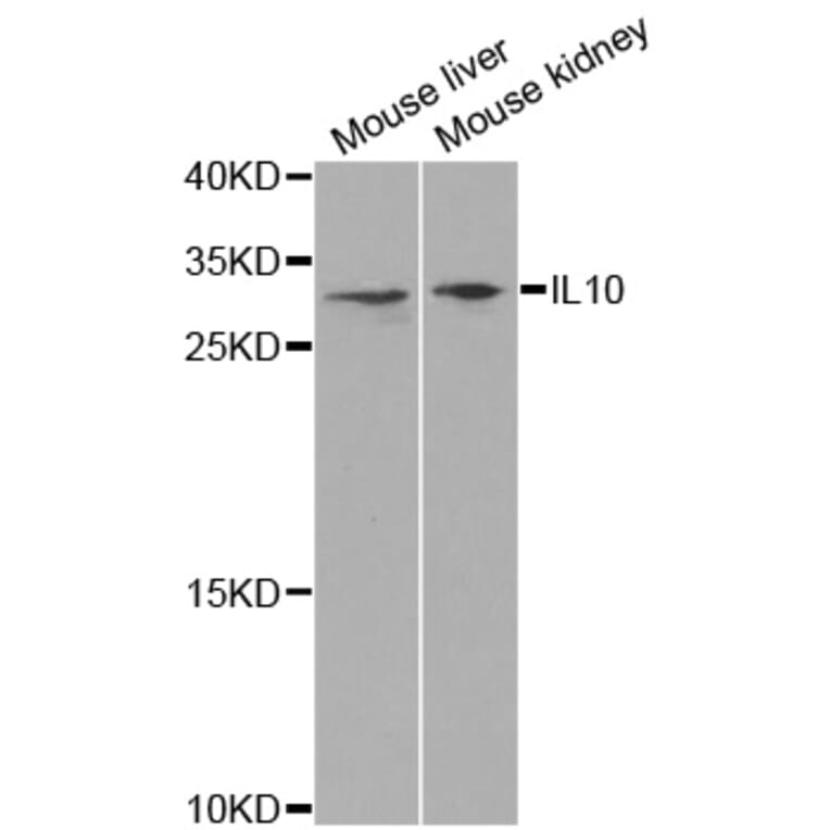 Western blot - IL10 antibody from Signalway Antibody (38392) - Antibodies.com