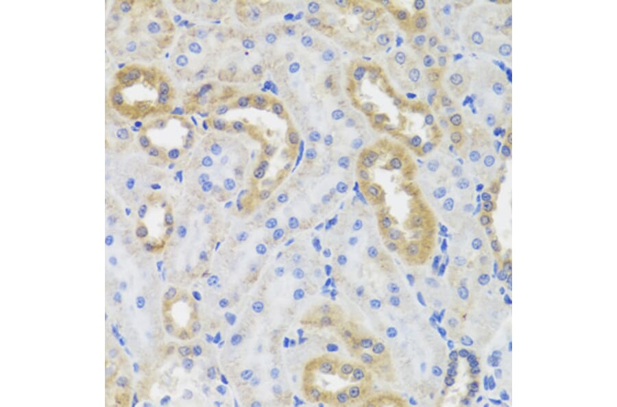 Immunohistochemistry - IL10 antibody from Signalway Antibody (38392) - Antibodies.com