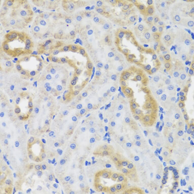 Immunohistochemistry - IL10 antibody from Signalway Antibody (38392) - Antibodies.com