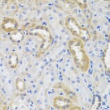 Immunohistochemistry - IL10 antibody from Signalway Antibody (38392) - Antibodies.com