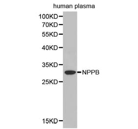 Western blot - NPPB antibody from Signalway Antibody (38393) - Antibodies.com