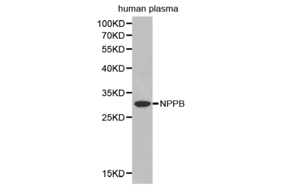 Western blot - NPPB antibody from Signalway Antibody (38393) - Antibodies.com