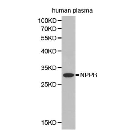 Western blot - NPPB antibody from Signalway Antibody (38393) - Antibodies.com