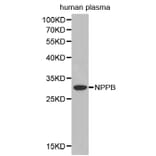 Western blot - NPPB antibody from Signalway Antibody (38393) - Antibodies.com