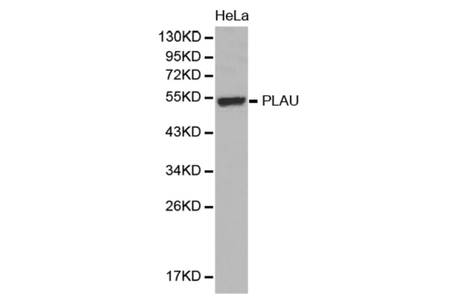 Western blot - PLAU antibody from Signalway Antibody (38394) - Antibodies.com