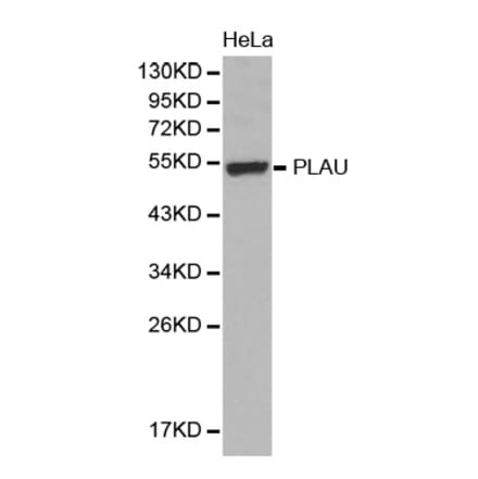 Western blot - PLAU antibody from Signalway Antibody (38394) - Antibodies.com