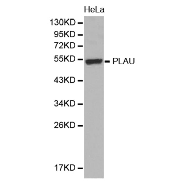 Western blot - PLAU antibody from Signalway Antibody (38394) - Antibodies.com
