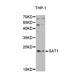 Western blot - SAT1 antibody from Signalway Antibody (38410) - Antibodies.com