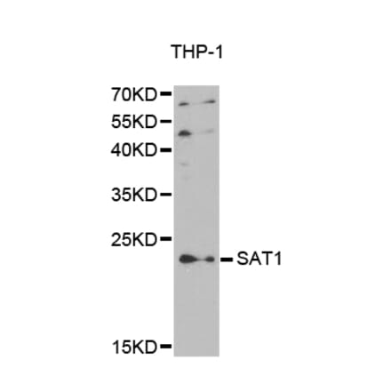 Western blot - SAT1 antibody from Signalway Antibody (38410) - Antibodies.com