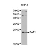 Western blot - SAT1 antibody from Signalway Antibody (38410) - Antibodies.com