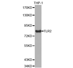 Western blot - TLR2 antibody from Signalway Antibody (38422) - Antibodies.com