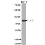 Western blot - TLR2 antibody from Signalway Antibody (38422) - Antibodies.com