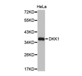 Western blot - DKK1 antibody from Signalway Antibody (38427) - Antibodies.com