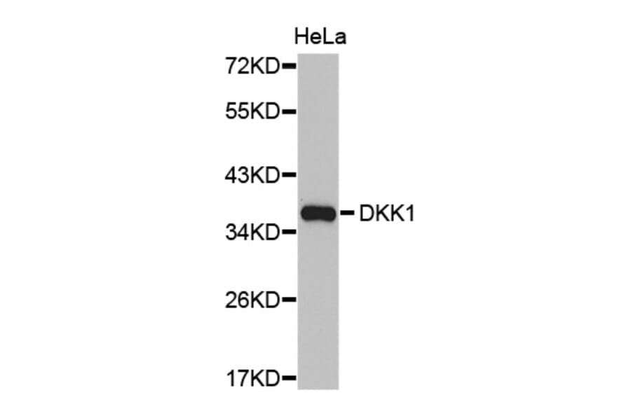 Western blot - DKK1 antibody from Signalway Antibody (38427) - Antibodies.com