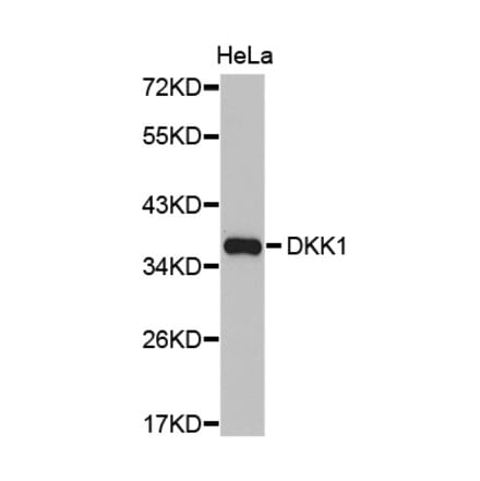 Western blot - DKK1 antibody from Signalway Antibody (38427) - Antibodies.com