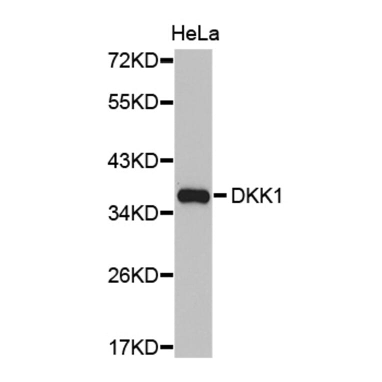 Western blot - DKK1 antibody from Signalway Antibody (38427) - Antibodies.com