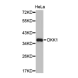 Western blot - DKK1 antibody from Signalway Antibody (38427) - Antibodies.com