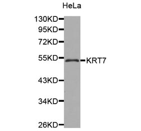 Western blot - KRT7 antibody from Signalway Antibody (38429) - Antibodies.com