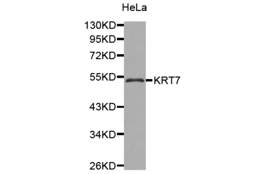 Western blot - KRT7 antibody from Signalway Antibody (38429) - Antibodies.com