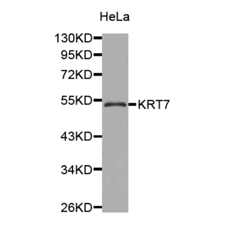 Western blot - KRT7 antibody from Signalway Antibody (38429) - Antibodies.com
