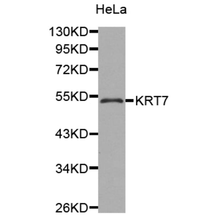 Western blot - KRT7 antibody from Signalway Antibody (38429) - Antibodies.com