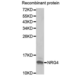 Western blot - NRG4 antibody from Signalway Antibody (38430) - Antibodies.com