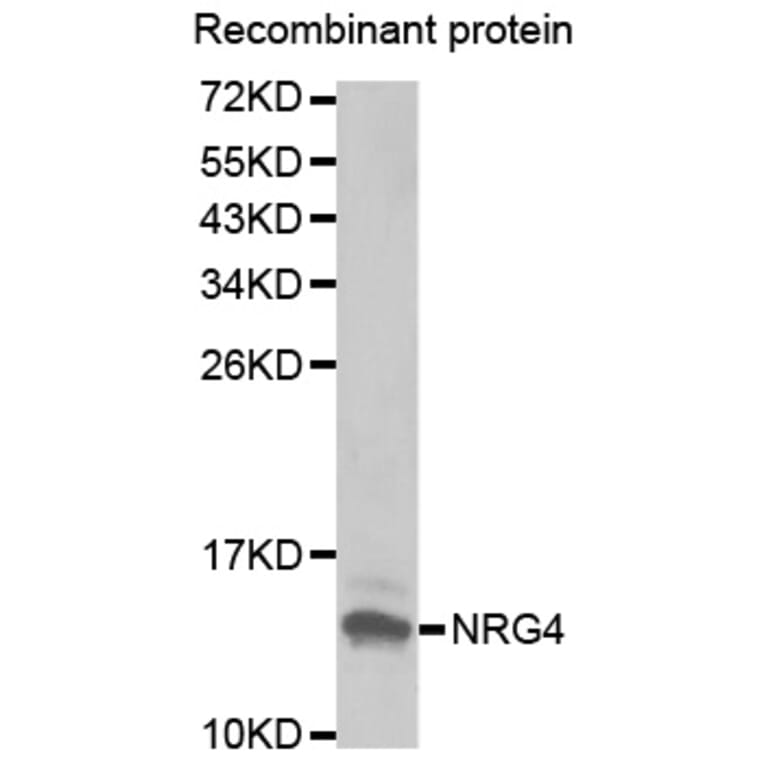 Western blot - NRG4 antibody from Signalway Antibody (38430) - Antibodies.com