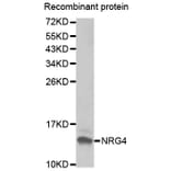 Western blot - NRG4 antibody from Signalway Antibody (38430) - Antibodies.com