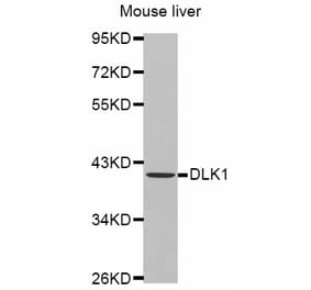 Western blot - DLK1 antibody from Signalway Antibody (38446) - Antibodies.com