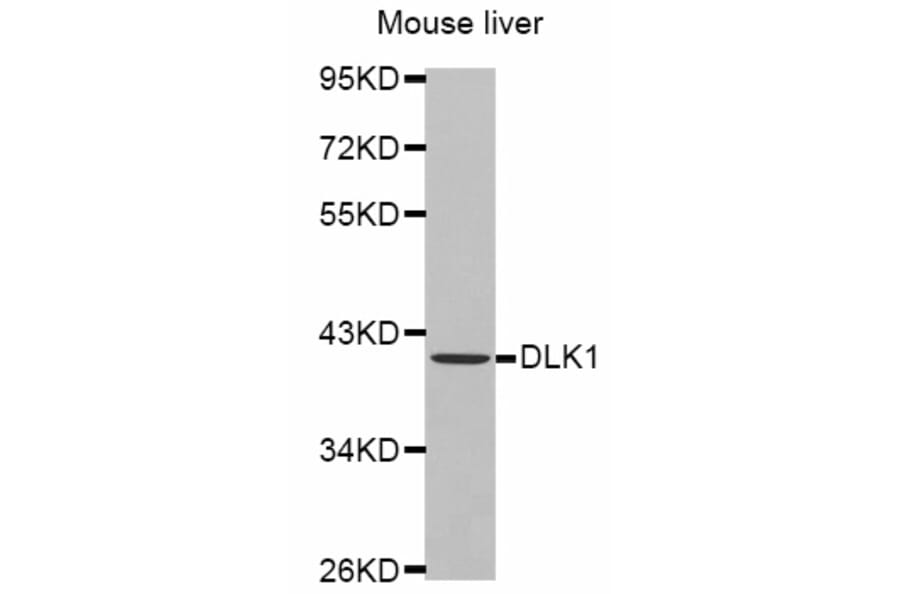 Western blot - DLK1 antibody from Signalway Antibody (38446) - Antibodies.com